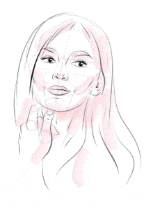 Illustration of face showing treatments lines for botox wrinkle treatment