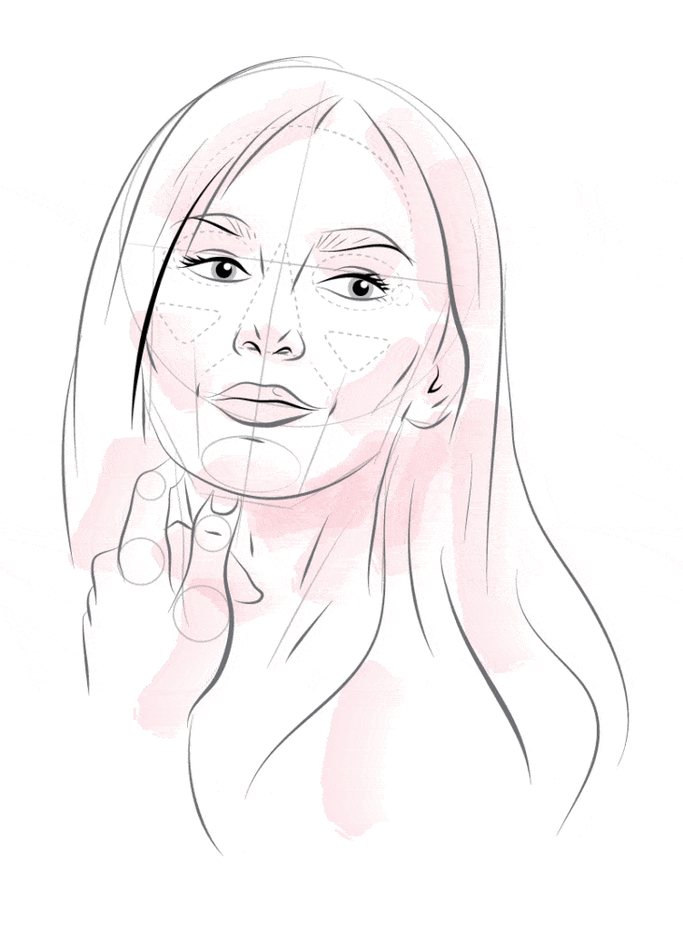 Botox London Wrinkle Treatment with Botox Injections illustration, Face Clinic London