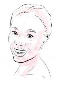 Illustration of face showing treatments lines for botox wrinkle treatment