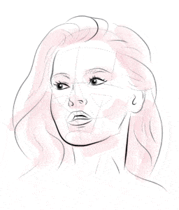 Illustration of face showing treatments lines for botox wrinkle treatment