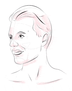 Illustration of face showing treatments lines for botox wrinkle treatment