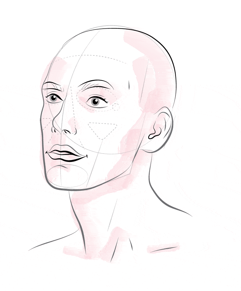 Illustration of Secret RF model with reduced wrinkles, reduced fine lines, improved neck scars, improved acne scars and reduced striae (stretch marks)