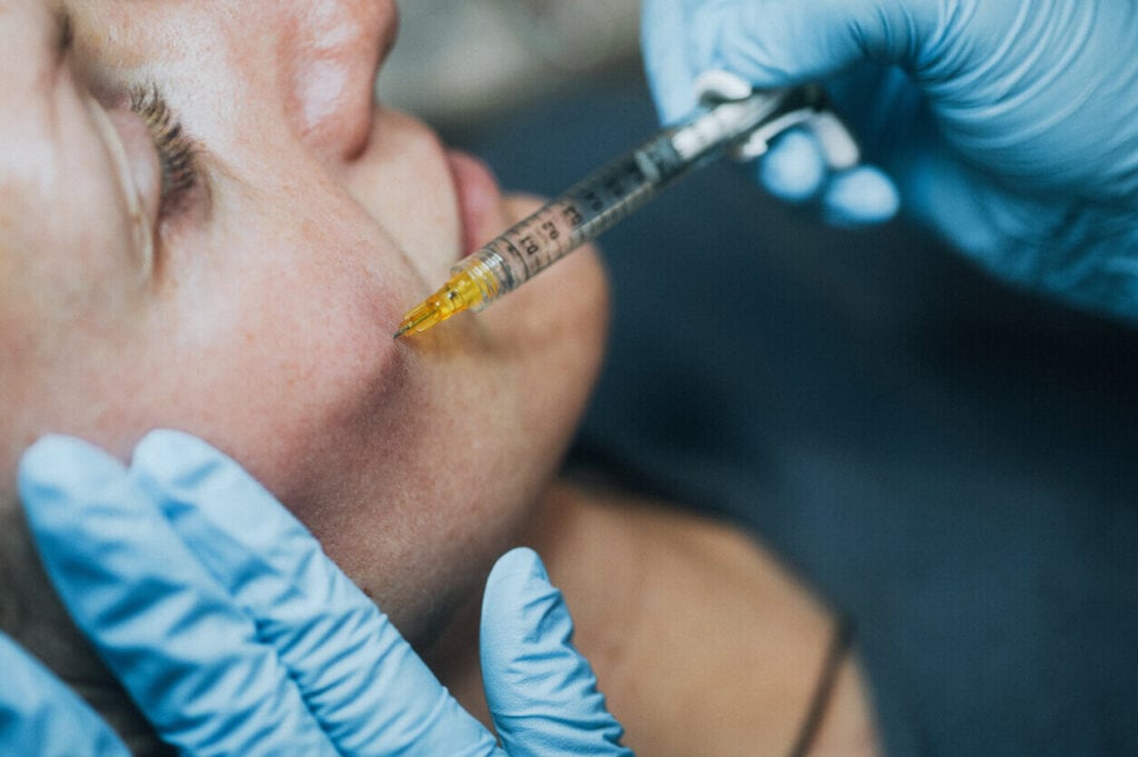 Botox and dermal fillers - Trained professional injecting dermal fillers to a female patient.