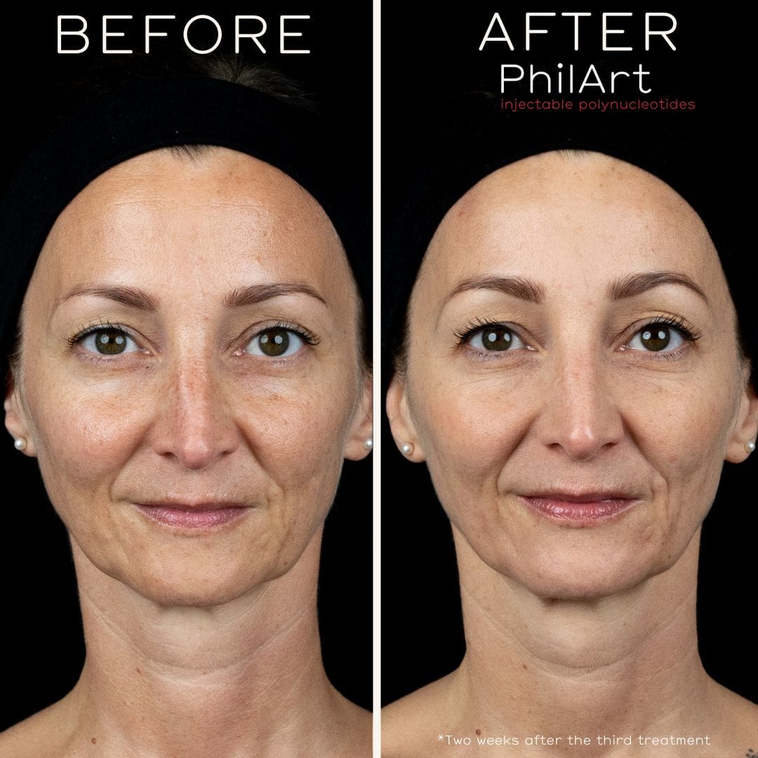 Face Clinic London