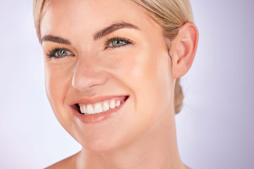 Woman with Smile lines filler injection using dermal fillers in London